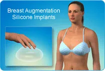 Silicone breast implants video